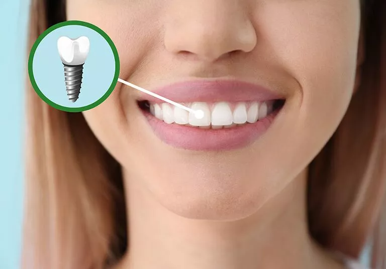 4 Common Dental Myths Debunked By Dentists